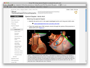 screen capture of TEE spectral Doppler web page